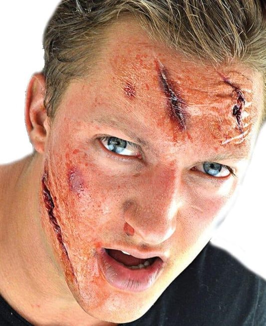 Afbeelding van Woochie FX Injury Kit